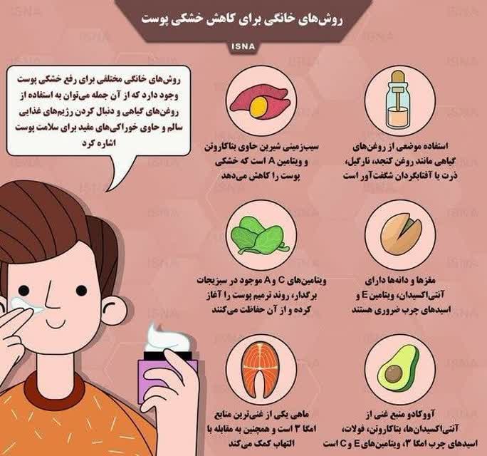 اینفوگرافیک